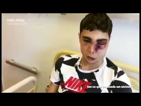 GILETS JAUNES: VIOLENT POLICE STATE REPRESSION OF PEACEFUL PROTEST