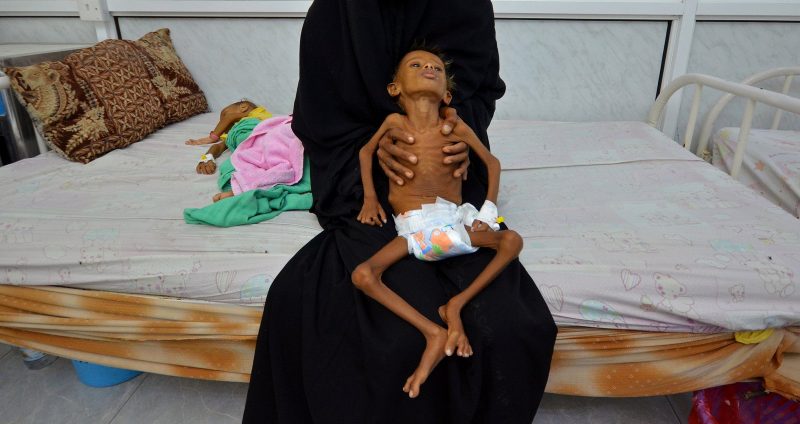 yemen-famine