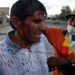 a_supporter_of_evo_morales_is_injured_by_the_jeanine_axez_administrationxs_security_forces_in_cochabambax_boliviax_nov__18x_2019_.jpg_1718483346