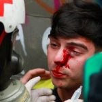 an_injured_student_is_helped_by_medical_staff_during_a_protest_against_president_sebastian_pixera_in_santiagox_chile_nov__8x_2019_.jpg_1718483346
