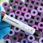 iatencion_21_dos_casos_de_coronavirus_en_venezuela_son_de_contagio_local_28_2Bdetalles_29