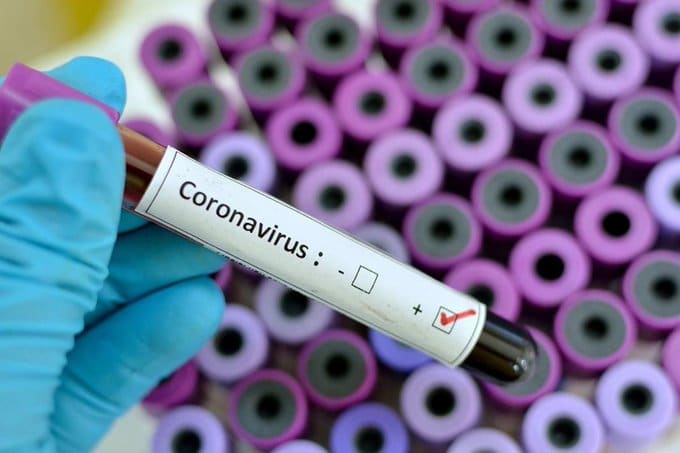 iatencion_21_dos_casos_de_coronavirus_en_venezuela_son_de_contagio_local_28_2Bdetalles_29