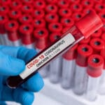 Person holding a blood sample of COVID-19 Omicron B.1.1.529 Variant and general data of COVID-19 Coronavirus Mutations. Photo by Getty Images.