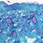 A look at the monkeypox at a cellular level.