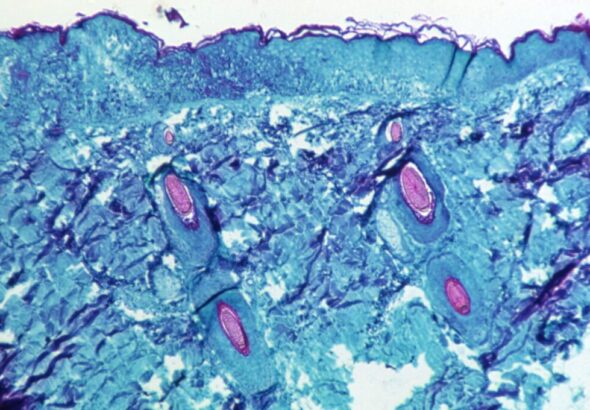 A look at the monkeypox at a cellular level.