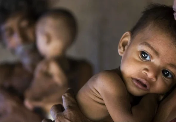 Woman holding a malnourished children. Photo: Getty Images.