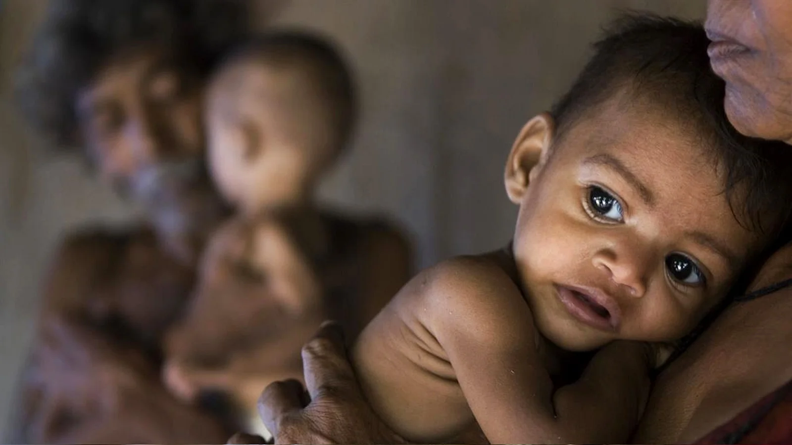 Woman holding a malnourished children. Photo: Getty Images.