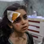 An injured Palestinian girl is taken to hospital following Israeli airstrikes over Rafah, located in the southern Gaza. Photo: Anadolu Agency.