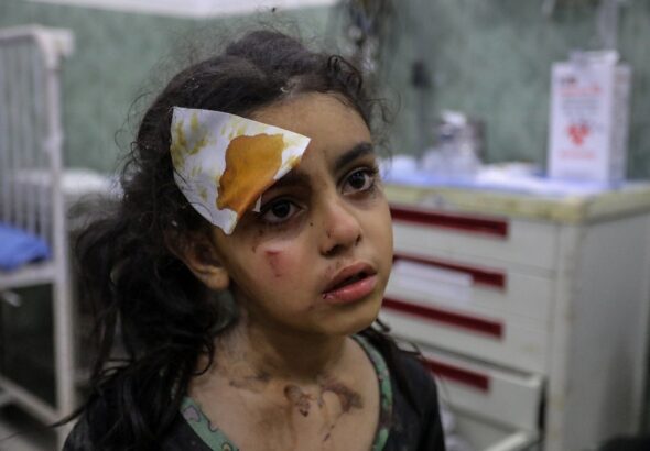 An injured Palestinian girl is taken to hospital following Israeli airstrikes over Rafah, located in the southern Gaza. Photo: Anadolu Agency.