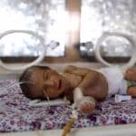 A premature baby lies in an incubator at the child care unit of a hospital in Sana'a, Yemen, January 16, 2018. File photo by Reuters.