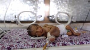 A premature baby lies in an incubator at the child care unit of a hospital in Sana'a, Yemen, January 16, 2018. File photo by Reuters.