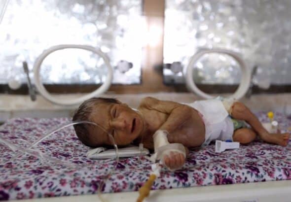 A premature baby lies in an incubator at the child care unit of a hospital in Sana'a, Yemen, January 16, 2018. File photo by Reuters.