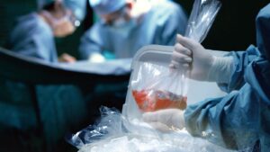 Human organ being taken out of a cooler full of ice by a person wearing surgery gear while two healthcare personnel seem to practice a surgical procedure in the background. Photo: RT News.