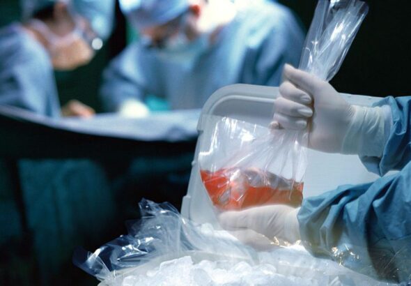 Human organ being taken out of a cooler full of ice by a person wearing surgery gear while two healthcare personnel seem to practice a surgical procedure in the background. Photo: RT News.
