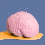 Brain with pins and needles sticking out. Photo: Pepino de Mar studio/Stocksy United/File photo.