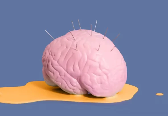 Brain with pins and needles sticking out. Photo: Pepino de Mar studio/Stocksy United/File photo.