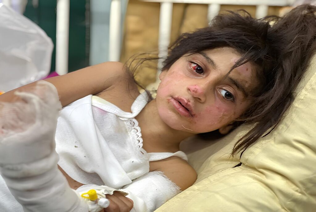An injured Palestinian child. Photo: Mahmoud Ajjour/The Palestine Chronicle.