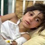 An injured Palestinian child. Photo: Mahmoud Ajjour/The Palestine Chronicle.