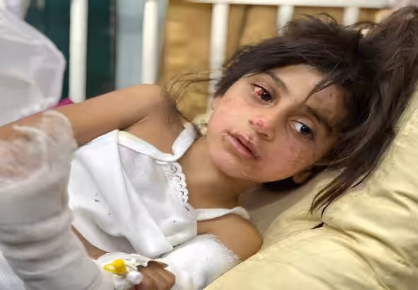 An injured Palestinian child. Photo: Mahmoud Ajjour/The Palestine Chronicle.