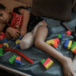 Palestinian boy with a leg amputated. Photo: QNN.