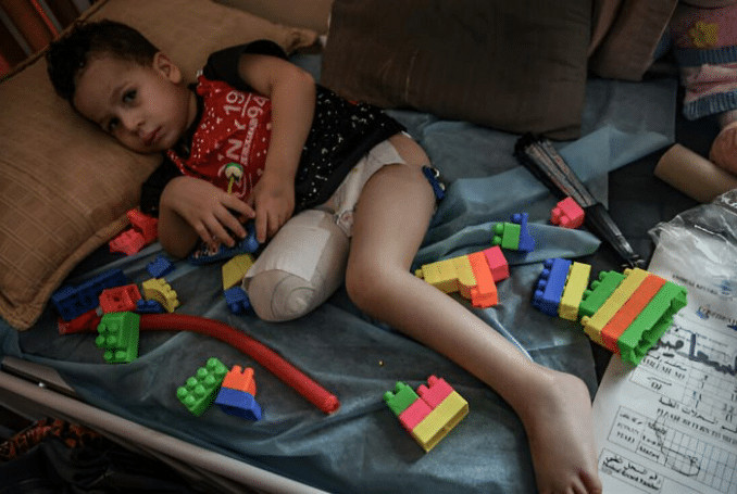 Palestinian boy with a leg amputated. Photo: QNN.