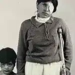 A young boy with an injury to his eye stands next to a young woman who has a crutch and is wearing an eye bandage. Photo: S. Brian Willson.