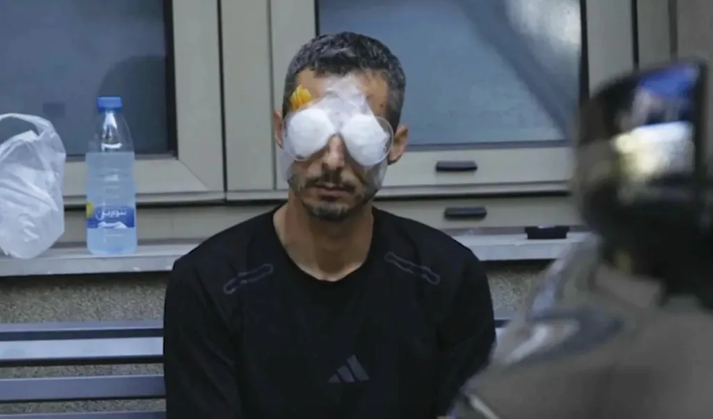 A victim of the September 2024 Lebanon pager and walkie-talkie terror attacks. The explosions, which involved thousands of handheld devices belonging to Hezbollah members, their families and other civilians, detonating simultaneously, killing dozens and injuring thousands of people, many of whom suffered severe eye injuries. Photo: Hussein Malla/AP Photo.