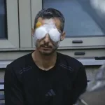 A victim of the September 2024 Lebanon pager and walkie-talkie terror attacks. The explosions, which involved thousands of handheld devices belonging to Hezbollah members, their families and other civilians, detonating simultaneously, killing dozens and injuring thousands of people, many of whom suffered severe eye injuries. Photo: Hussein Malla/AP Photo.