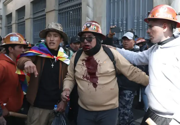 The bloodied shirt of an anti-neoliberal protestor following clashes with Rodrigo Paz's state forces. Photo: EFE.